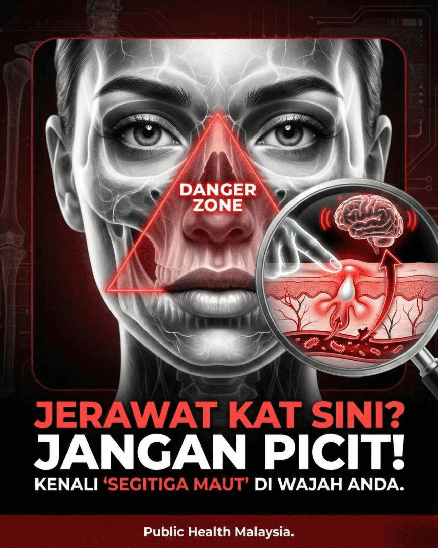 Bahaya, Jangan Picit Jerawat di Hidung!